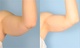before and after arms