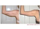 arms inch loss